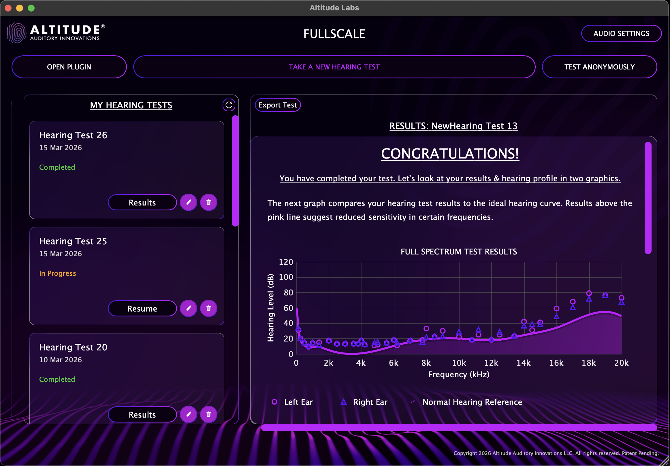 FullScale hearing test results with full spectrum audiogram