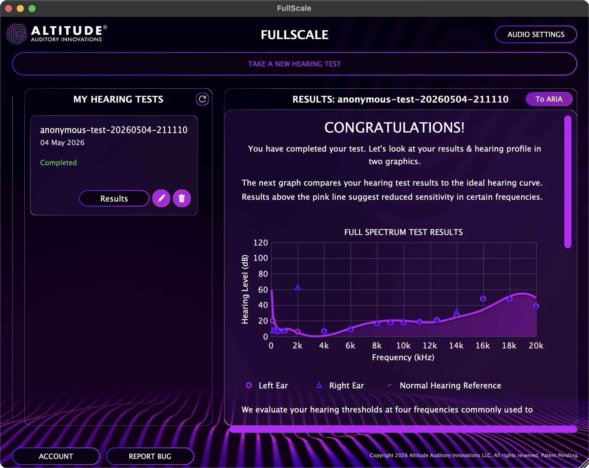 FullScale Hearing Test home screen with TO ARIA button
